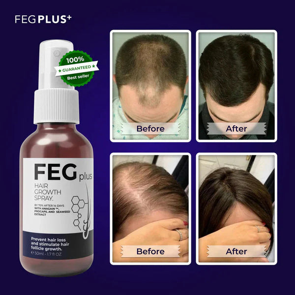 FEG Plus FEG Plus Hair Growth Spray